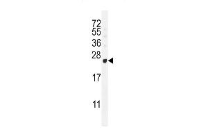 Western blot analysis in T47D cell line lysates (35ug/lane). (G Antigen 12B antibody  (N-Term))