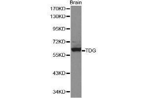 Western blot analysis of extracts of mouse brain, using TDG antibody. (TDG antibody  (AA 1-160))