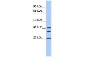 Calponin 1 antibody used at 1 ug/ml to detect target protein. (CNN1 antibody  (N-Term))