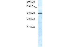 WB Suggested Anti-GFI1 Antibody Titration:  0. (GFI1 antibody  (N-Term))