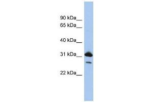 RAP1B antibody used at 1 ug/ml to detect target protein. (RAP1B antibody  (N-Term))