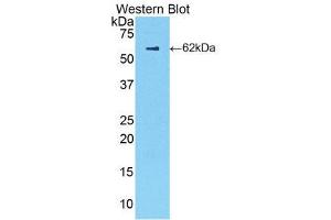 Western Blotting (WB) image for anti-Complement Factor B (CFB) (AA 34-159) antibody (ABIN3210066) (Complement Factor B antibody  (AA 34-159))