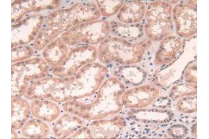 IHC-P analysis of Human Kidney Tissue, with DAB staining. (POR antibody  (AA 77-518))