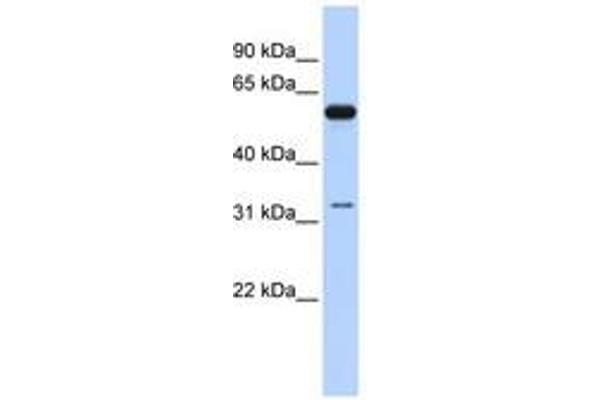 DDX28 antibody  (AA 107-156)