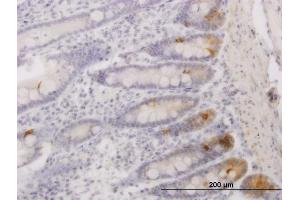 Immunoperoxidase of monoclonal antibody to SFRS17A on formalin-fixed paraffin-embedded human small Intestine. (SFRS17A antibody  (AA 53-156))
