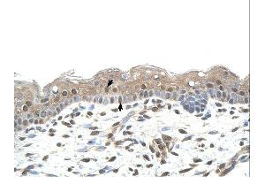 Immunohistochemistry (IHC) image for anti-Ring Finger Protein 25 (RNF25) (Middle Region) antibody (ABIN2774774) (RNF25 antibody  (Middle Region))