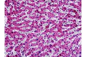 Human Liver: Formalin-Fixed, Paraffin-Embedded (FFPE) (Prostaglandin D2 Receptor 2 (PTGDR2) (AA 329-348) antibody)