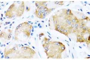 Immunohistochemistry of paraffin-embedded Human stomach using ACVR1C Polyclonal Antibody at dilution of 1:100 (40x lens). (ACVR1C/ALK7 antibody)