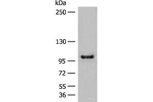 Western blot analysis of HEPG2 cell lysate using CTDP1 Polyclonal Antibody at dilution of 1:500 (CTDP1 antibody)