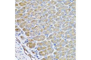 Immunohistochemistry of paraffin-embedded mouse stomach using VPS37A antibody (ABIN5975733) at dilution of 1/100 (40x lens). (VPS37A antibody)