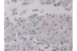 Detection of UNG in Human Stomach Tissue using Polyclonal Antibody to Uracil DNA Glycosylase (UNG)