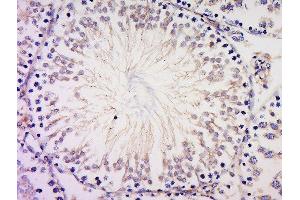 Paraformaldehyde-fixed, paraffin embedded Rat Testis, Antigen retrieval by boiling in sodium citrate buffer (pH6) for 15min, Block endogenous peroxidase by 3% hydrogen peroxide for 30 minutes, Blocking buffer (BSA or normal goat serum) at 37°C for 20min, Antibody incubation with Rabbit Anti-PIBF Polyclonal Antibody, Unconjugated  ) at 1:500 overnight at 4°C, followed by a conjugated secondary and DAB staining. (PIBF1 antibody  (AA 551-650))