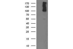 Western Blotting (WB) image for anti-phosphodiesterase 2A, CGMP-Stimulated (PDE2A) antibody (ABIN1500079)