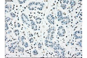 Image no. 1 for anti-Checkpoint Kinase 2 (CHEK2) antibody (ABIN1497496) (CHEK2 antibody)