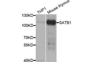 Western blot analysis of extracts of THP1 and mouse thymus cell lines, using SATB1 antibody. (SATB1 antibody)