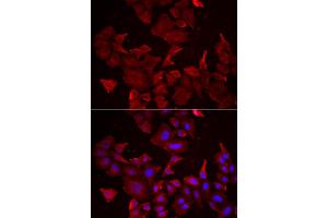 Immunofluorescence analysis of HeLa cells using CASP14 antibody (ABIN5973925). (CASP14 antibody)