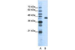 WB Suggested Anti-ZFP36L2  Antibody Titration: 1. (ZFP36L2 antibody  (N-Term))