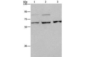 Western Blot analysis of A431, MCF-7 and Hela cell using KIF22 Polyclonal Antibody at dilution of 1:200 (KIF22 antibody)