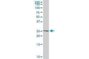 RALB MaxPab rabbit polyclonal antibody. (RALB antibody  (AA 1-206))
