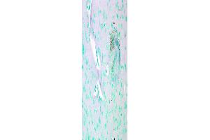 Image no. 4 for anti-Calcium Channel, Voltage-Dependent, L Type, alpha 1C Subunit (CACNA1C) (AA 1507-1733) antibody (ABIN361759)
