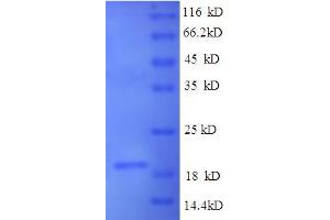 SDS-PAGE (SDS) image for Integrin alpha V (ITGAV) (AA 891-1048) protein (His tag) (ABIN5713570) (CD51 Protein (AA 891-1048) (His tag))