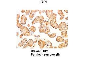 Lanes: Human placenta Primary Antibody Dilution: 1:500Secondary Antibody: Anti-rabbit-HRP Secondary Antibody Dilution: 1:0000  Gene Name: Brown: LRP1 Purple: Haemotoxylin Submitted by: LRP1 (LRP1 antibody  (Middle Region))
