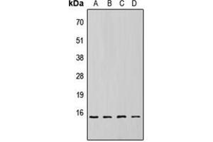 Western blot analysis of 4EBP1 (pT69) expression in HEK293T (A), NS-1 (B), H9C2 (C), rat liver (D) whole cell lysates.
