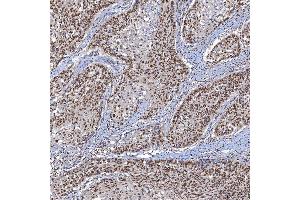 IHC analysis of TRMT61A using anti-TRMT61A antibody (ABIN7599220). (TRMT61A antibody  (AA 1-289))