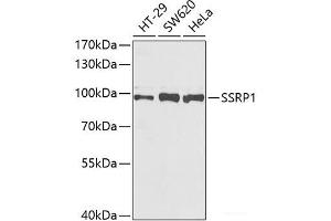 Western blot analysis of extracts of various cell lines using SSRP1 Polyclonal Antibody at dilution of 1:1000.