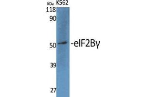 Western Blot (WB) analysis of specific cells using eIF2Bgamma Polyclonal Antibody. (EIF2B3 antibody  (Internal Region))