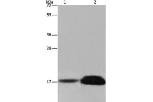 Western Blot analysis of Mouse kidney and Human kidney tissue using FHIT Polyclonal Antibody at dilution of 1:600 (FHIT antibody)
