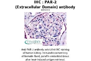 Image no. 1 for anti-Nuclear Receptor Subfamily 1, Group I, Member 2 (NR1I2) (2nd Extracellular Domain) antibody (ABIN1737849)