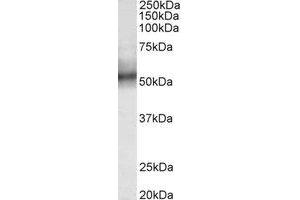Western Blotting (WB) image for anti-Tripartite Motif Containing 11 (TRIM11) (Internal Region) antibody (ABIN2465007) (TRIM11 antibody  (Internal Region))