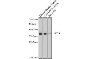 Western blot analysis of extracts of various cell lines using ART5 Polyclonal Antibody at dilution of 1:1000. (ART5 antibody)