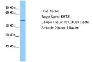 Image no. 1 for anti-Keratin 31 (KRT31) (AA 299-348) antibody (ABIN6750207) (Keratin 31 antibody  (AA 299-348))