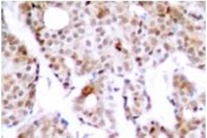 Image no. 1 for anti-Myc Proto-Oncogene protein (MYC) (pThr358) antibody (ABIN318074) (c-MYC antibody  (pThr358))