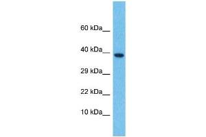 Host:  Rabbit  Target Name:  LEFTY2  Sample Type:  Thymus Tumor lysates  Antibody Dilution:  1. (LEFTY2 antibody  (N-Term))