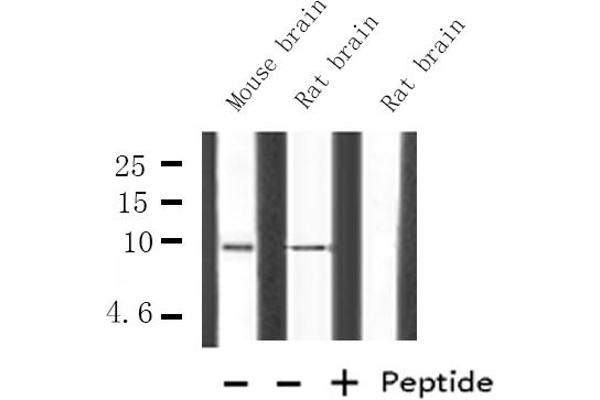 HMGN2 antibody  (Internal Region)
