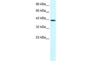 WB Suggested Anti-PTK2B Antibody Titration:  1.