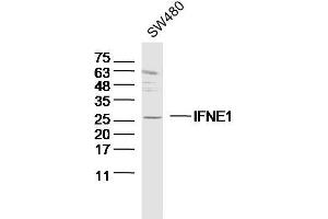 SW480 lysates probed with IFNE1 Polyclonal Antibody, Unconjugated  at 1:300 dilution and 4˚C overnight incubation. (IFNE antibody  (AA 101-200))