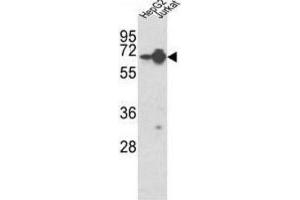 Western Blotting (WB) image for anti-Heterogeneous Nuclear Ribonucleoprotein L (HNRNPL) antibody (ABIN3001739) (HNRNPL antibody)