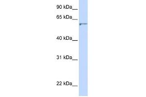 DHCR24 antibody used at 1 ug/ml to detect target protein. (Seladin 1 antibody  (N-Term))