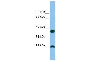 WFDC1 antibody used at 1 ug/ml to detect target protein. (WFDC1 antibody  (Middle Region))