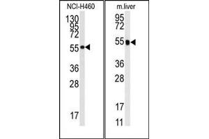 Image no. 1 for anti-Cytochrome P450, Family 2, Subfamily R, Polypeptide 1 (CYP2R1) (Middle Region) antibody (ABIN360263)