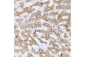 Immunohistochemistry of paraffin-embedded human liver using HDLBP antibody (ABIN6128051, ABIN6141701, ABIN6141702 and ABIN6221672) at dilution of 1:100 (40x lens). (HDLBP antibody  (AA 1035-1268))