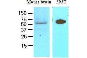 Cell lysates of mouse brain and 293T (50 ug) were resolved by SDS-PAGE, transferred to nitrocellulose membrane and probed with anti-human DACT3 (1:250). (DACT3 antibody  (AA 89-202))