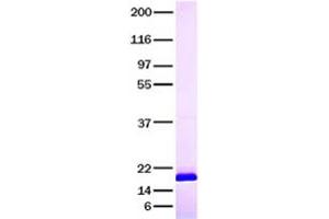 Western Blotting (WB) image for Interleukin 1 Receptor Antagonist (IL1RN) (Transcript Variant 3) (Active) protein (ABIN2723404)