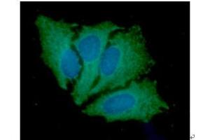 ICC/IF analysis of JAK2 in HeLa cells line, stained with DAPI (Blue) for nucleus staining and monoclonal anti-human JAK2 antibody (1:100) with goat anti-mouse IgG-Alexa fluor 488 conjugate (Green). (JAK2 antibody  (AA 1014-1132))