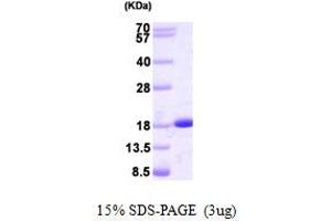 SDS-PAGE (SDS) image for Nucleoside diphosphate kinase B (NME2) (AA 1-152) protein (ABIN666951) (NME2 Protein (AA 1-152))