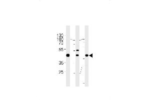 GTF2H2C Antibody (C-term) (ABIN655372 and ABIN2844928) western blot analysis in A549,K562,MCF-7 cell line lysates (35 μg/lane). (GTF2H2C antibody  (C-Term))